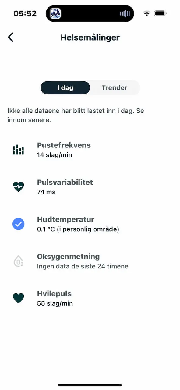 Fitbit Sense 2