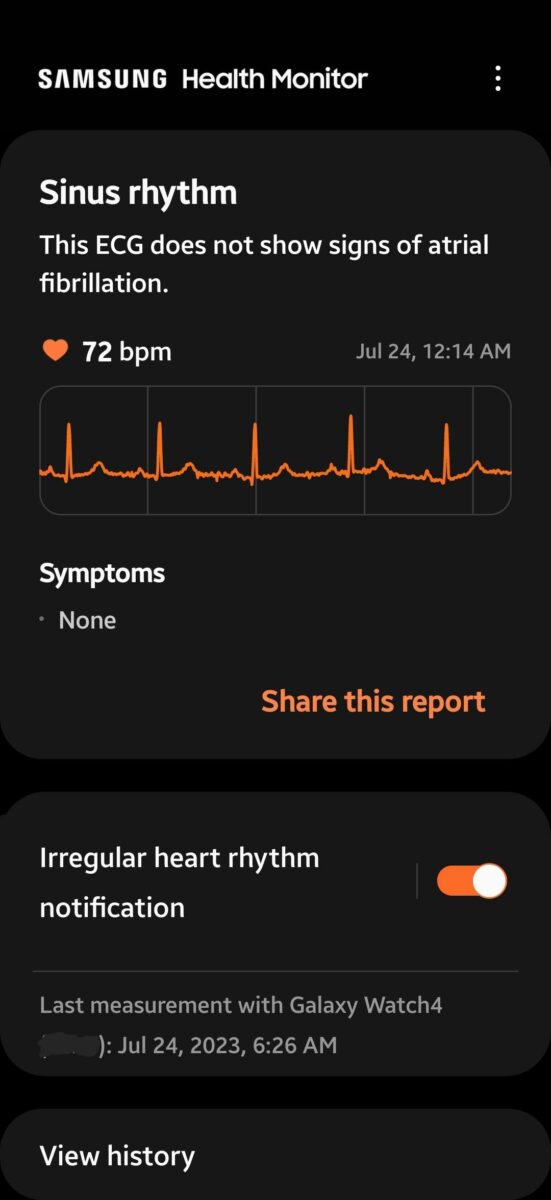 Samsung Galaxy Watch EKG