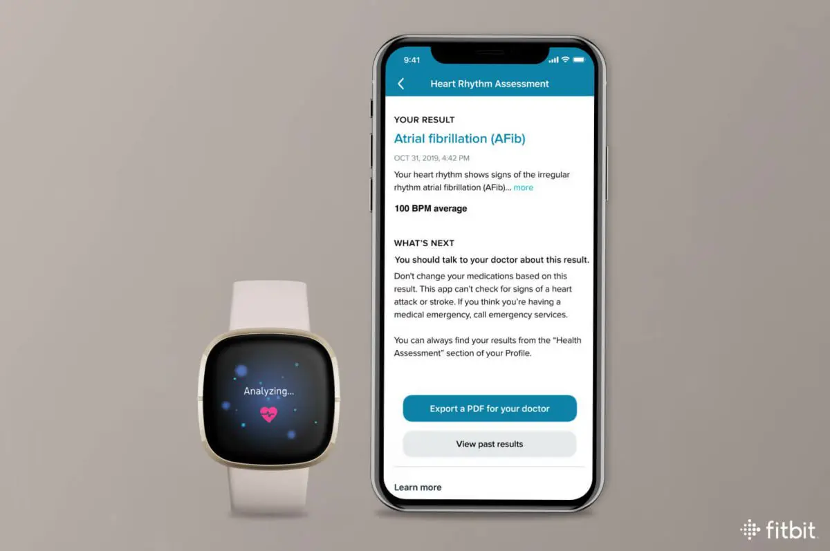 Fitbit AFib