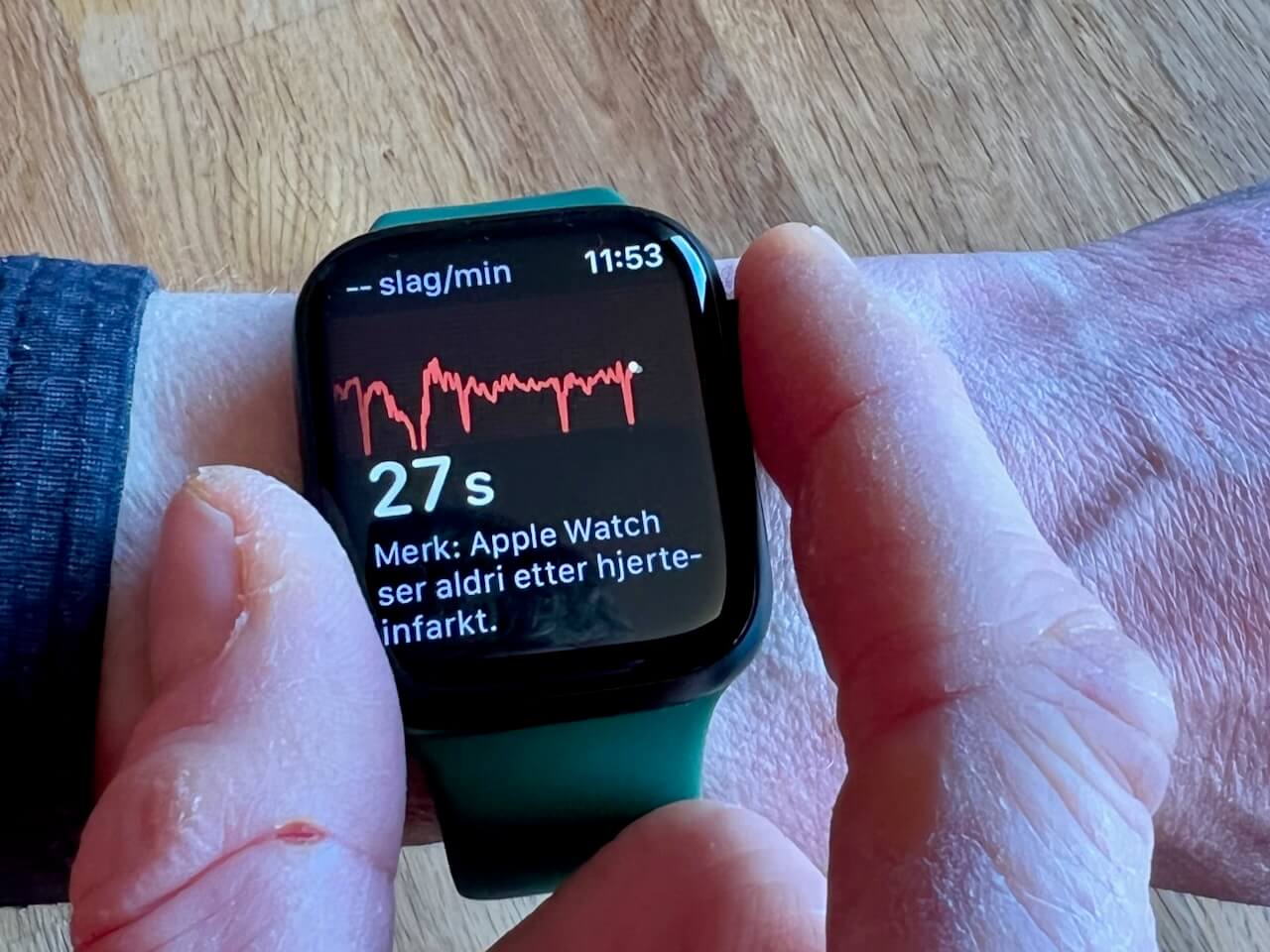 Apple Watch Series 7 EKG og SpO2