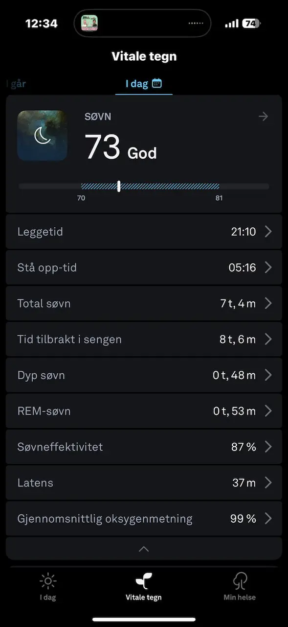 Oura Ring Gen 4