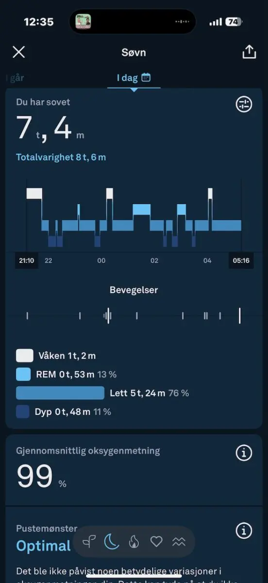 smartring test