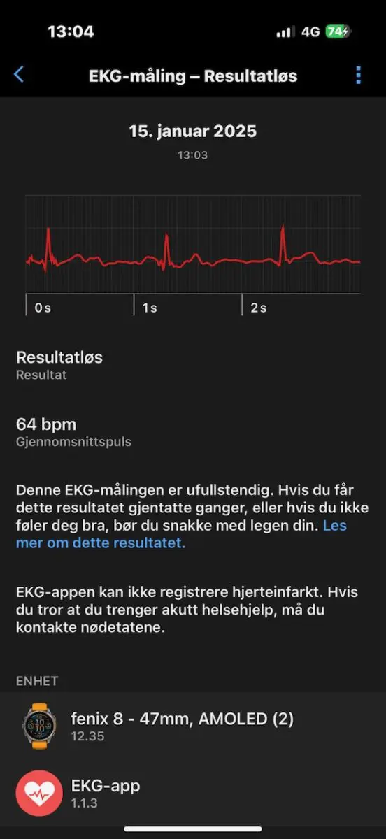 Garmin EKG