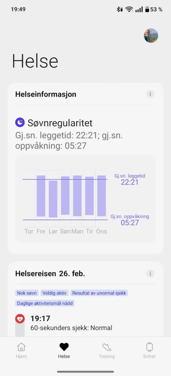 OnePlus Watch 3