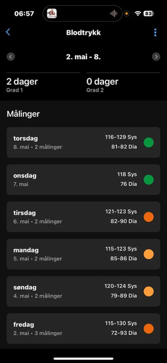 blodtrykksmåler test