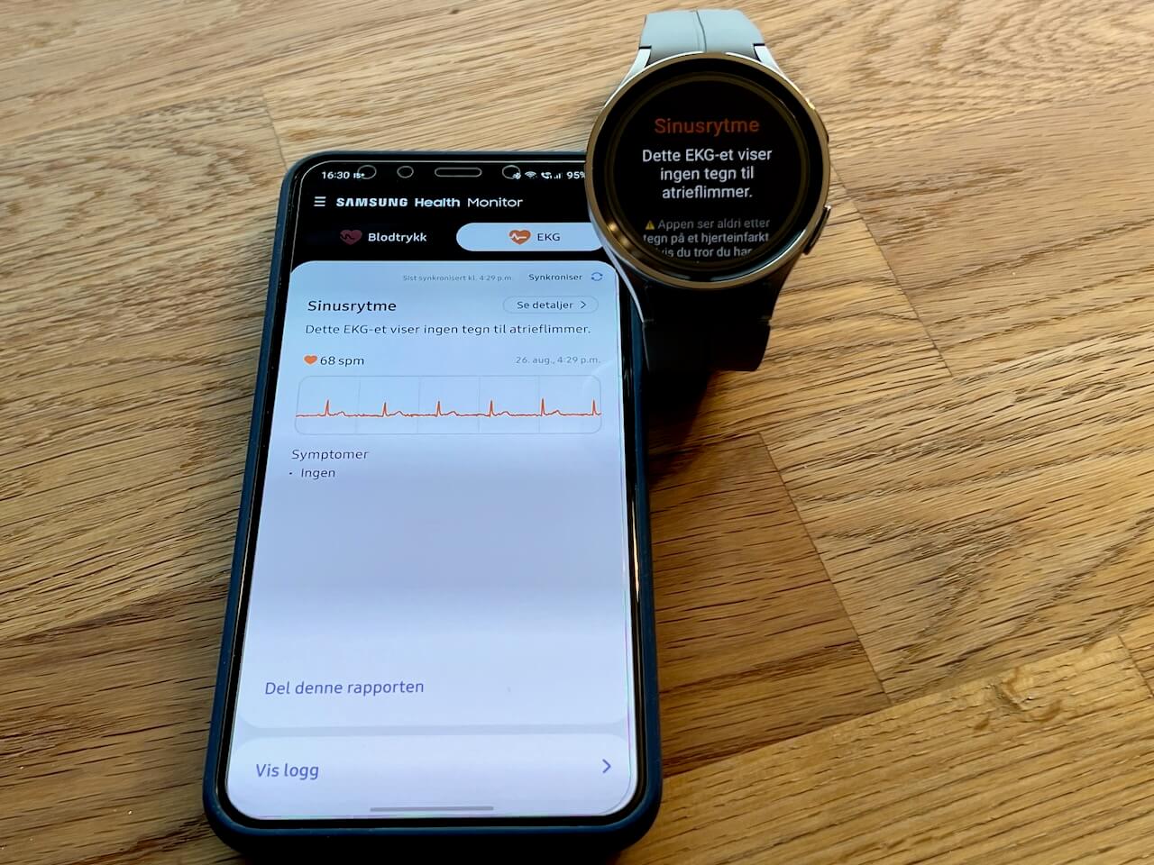 Featured image for “Samsung oppdaterer Galaxy Watch med  passiv deteksjon av uregelmessig hjerterytme”